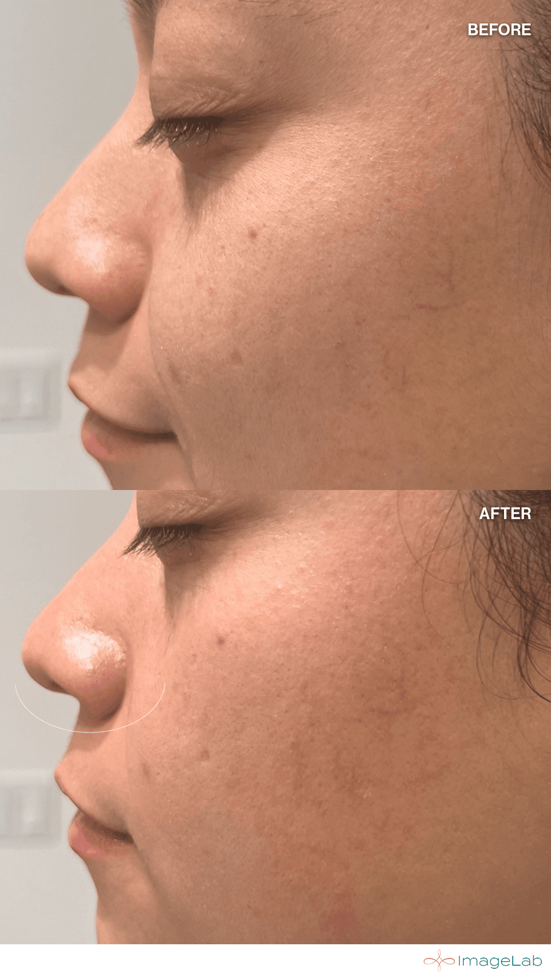 Custom Medical Facial result at ImageLab Med Spa