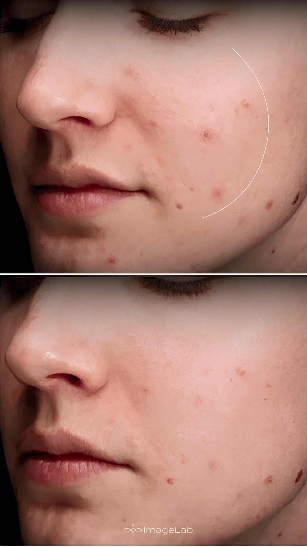 Before and after result