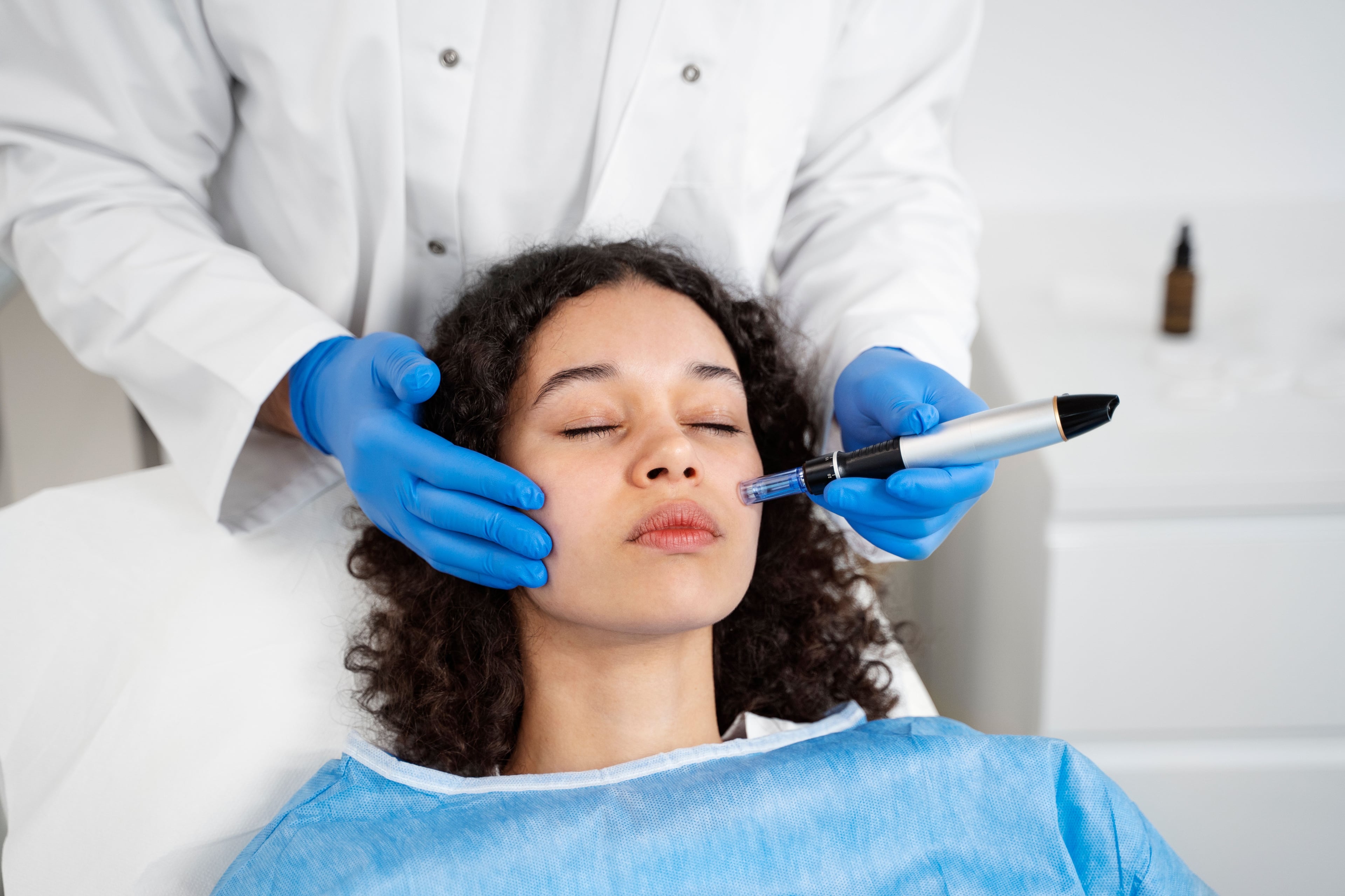 Microneedling vs Chemical Peel