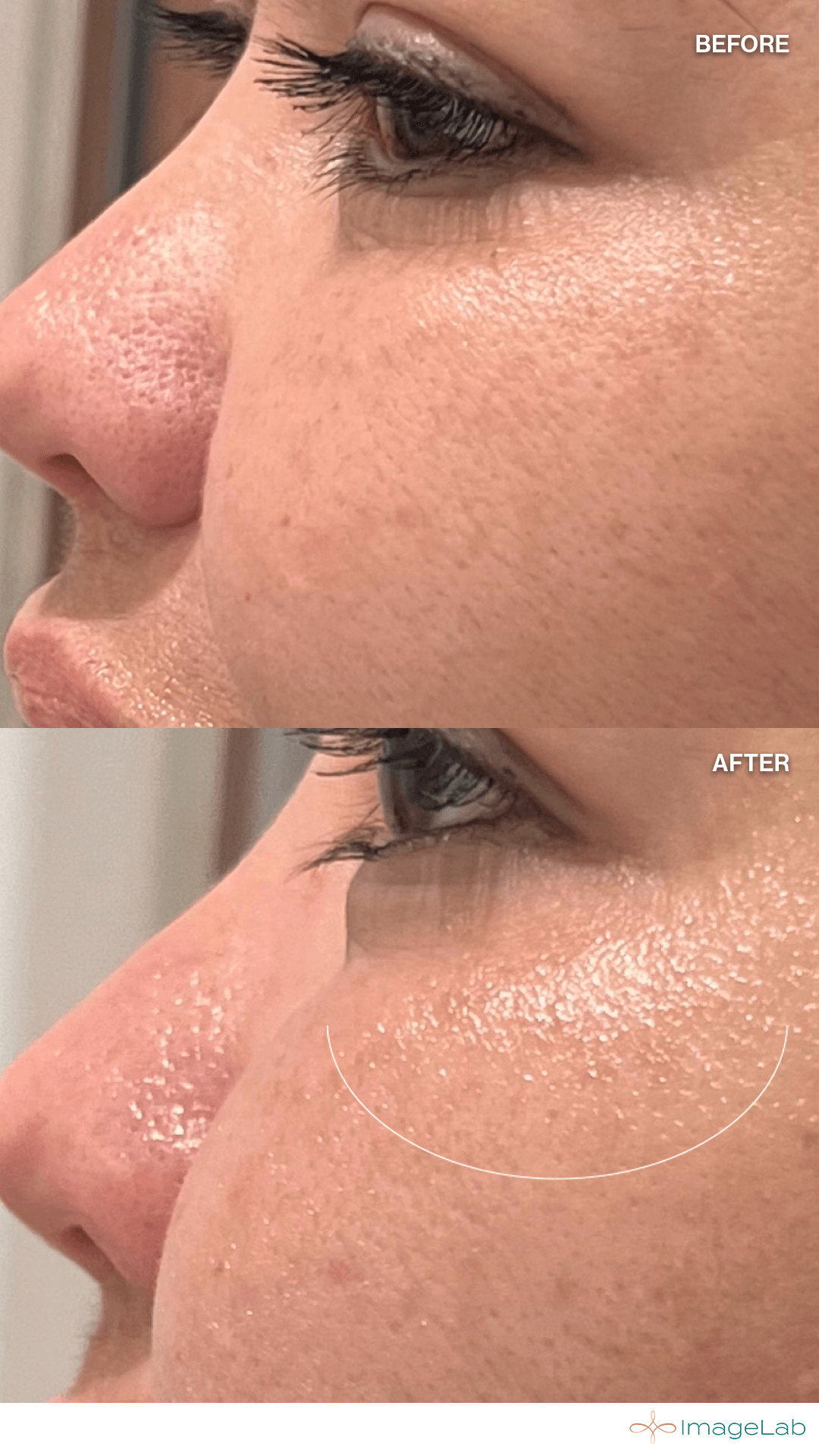 Before and after result