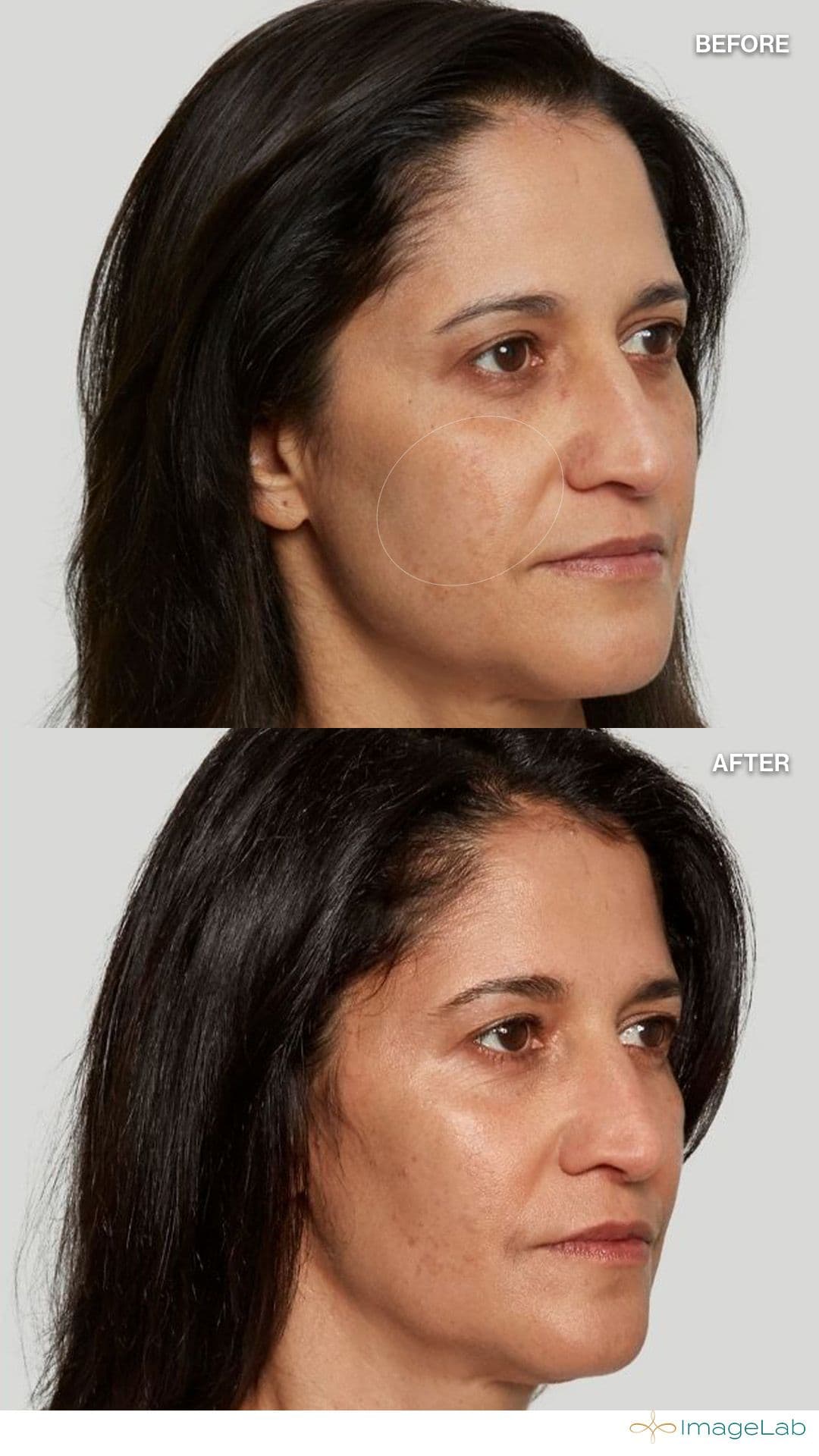 Before and after result