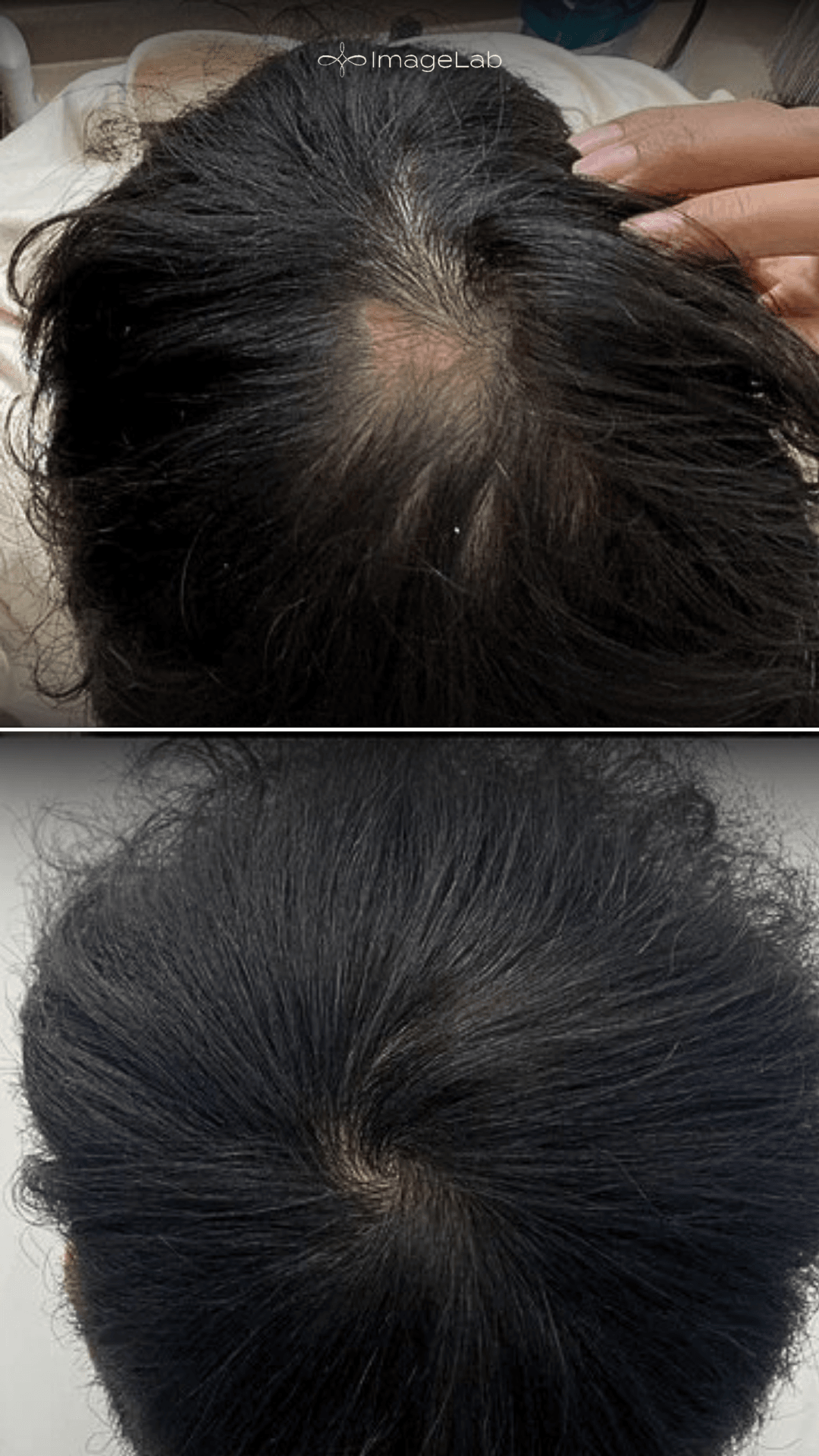 Before and after result