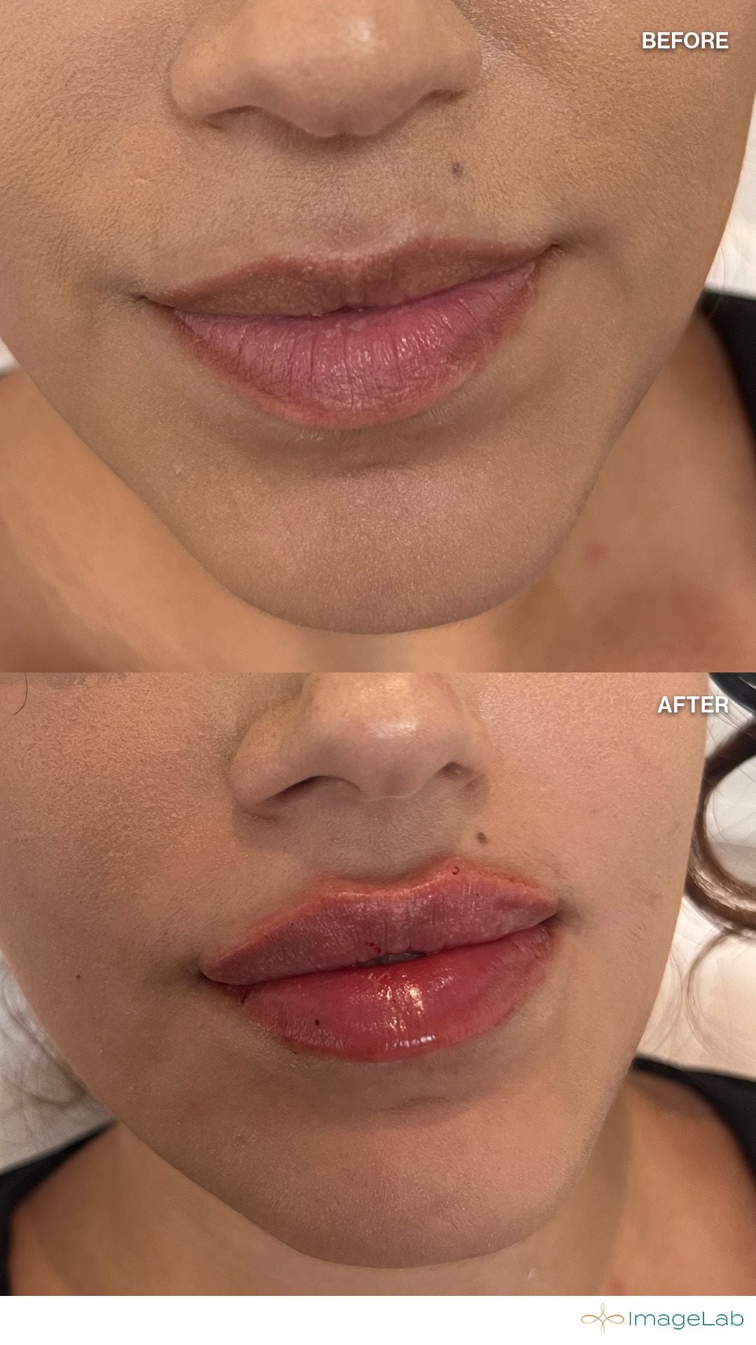 Before and after result