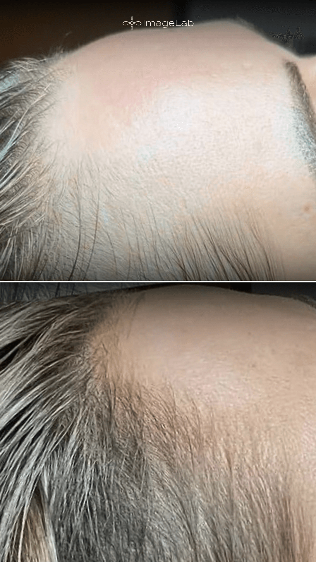 Before and after result