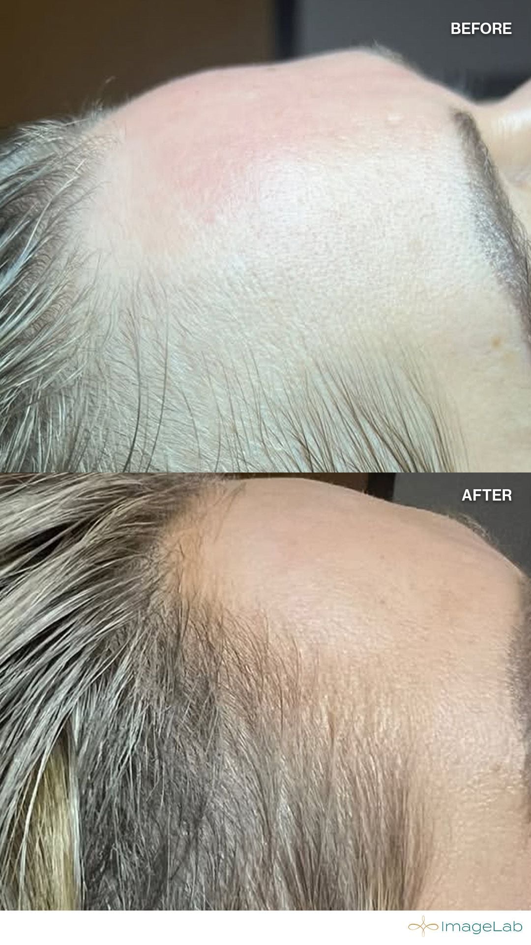 Before and after result