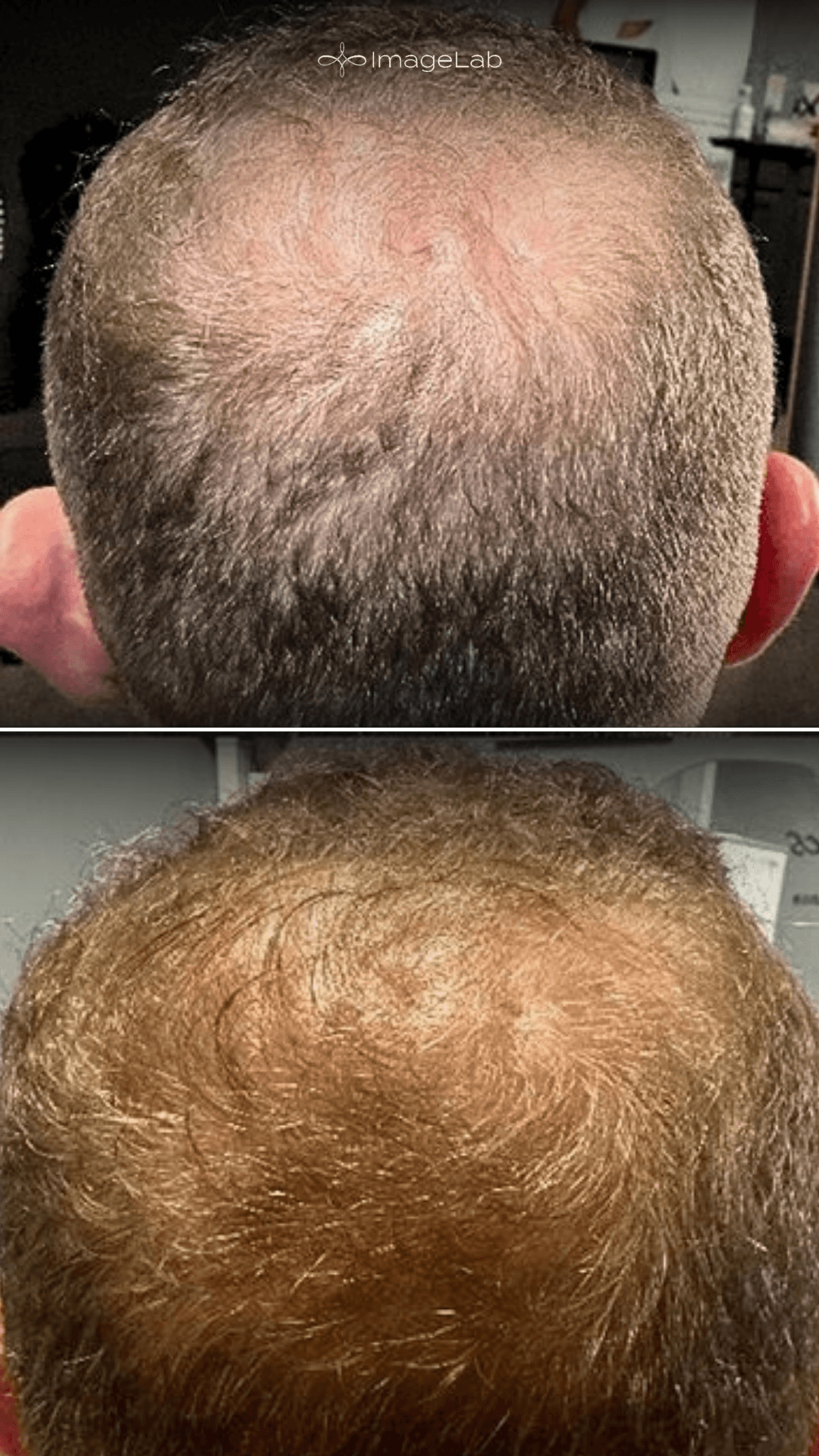 Before and after result