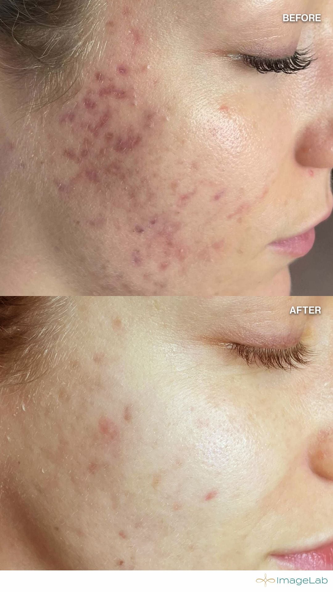 Before and after result