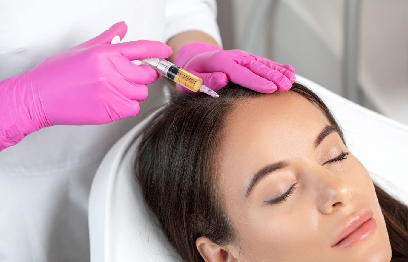prp hair restoration alexandria