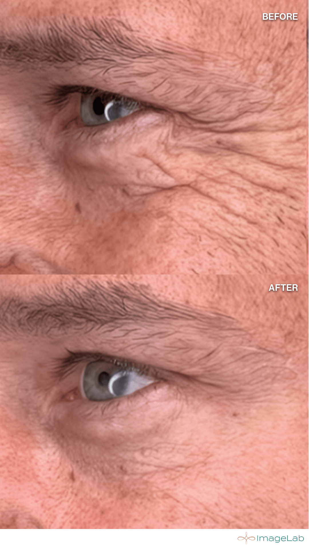 Before and after result