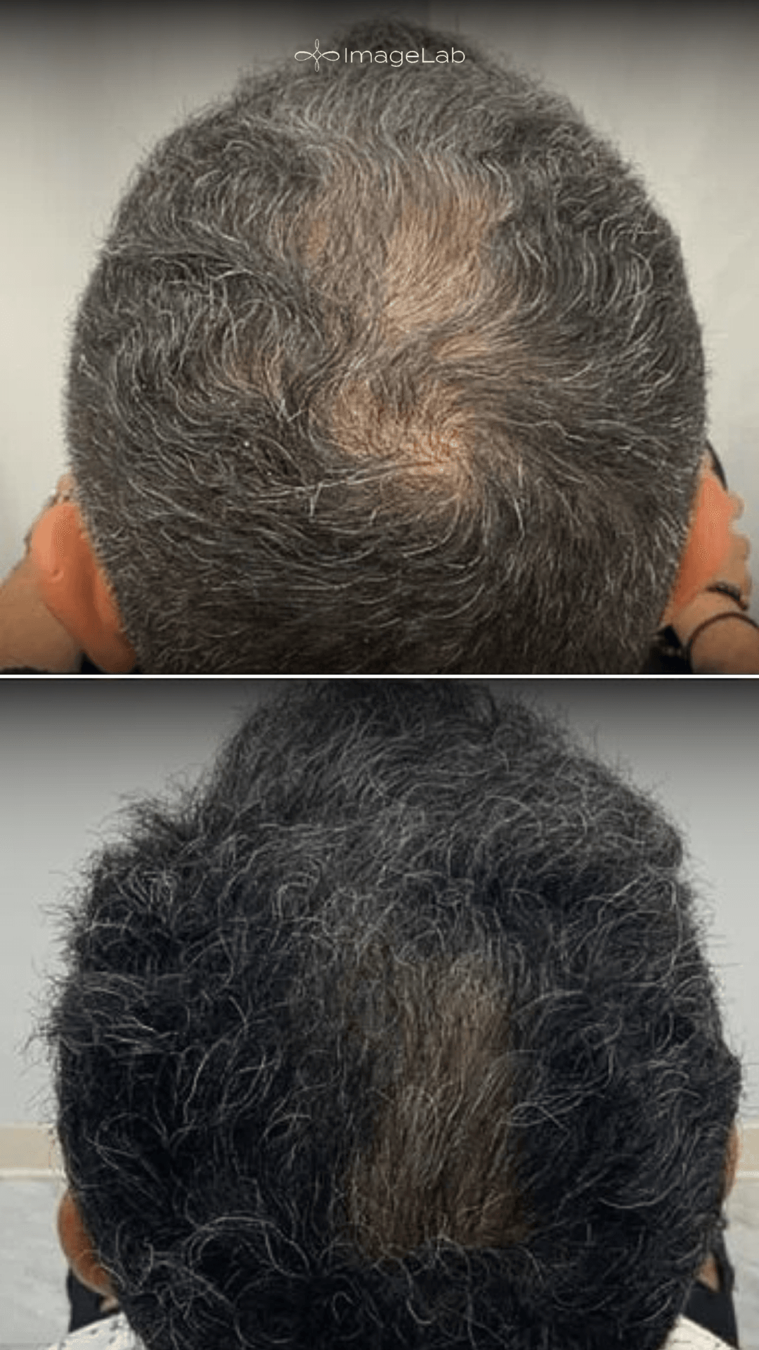 Before and after result