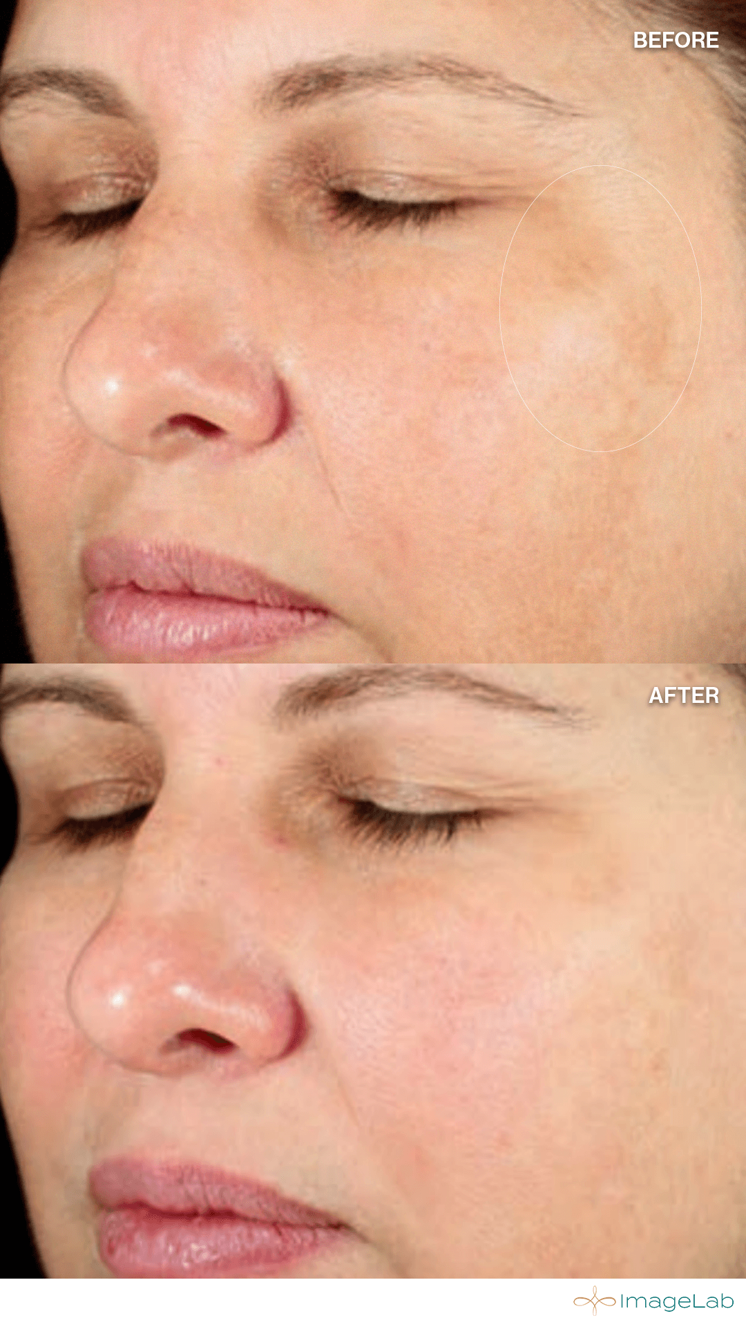 Before and after result
