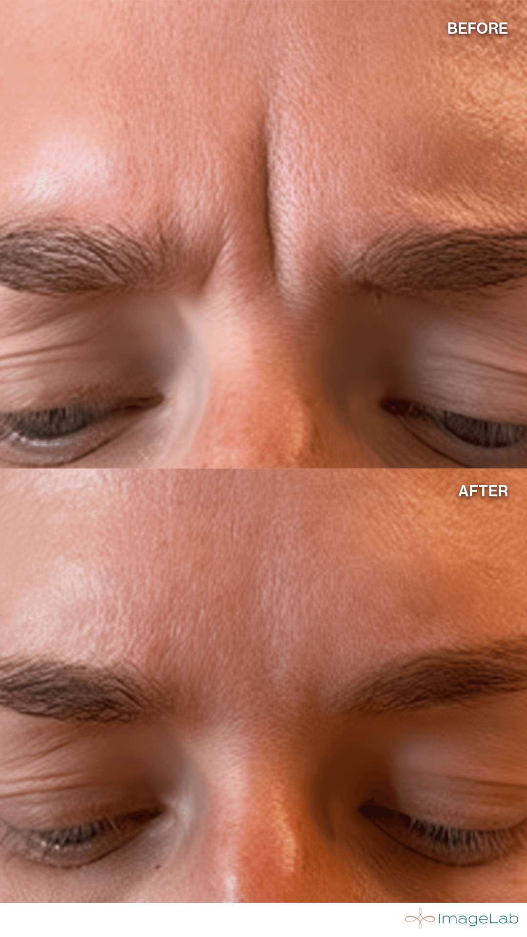 Before and after result