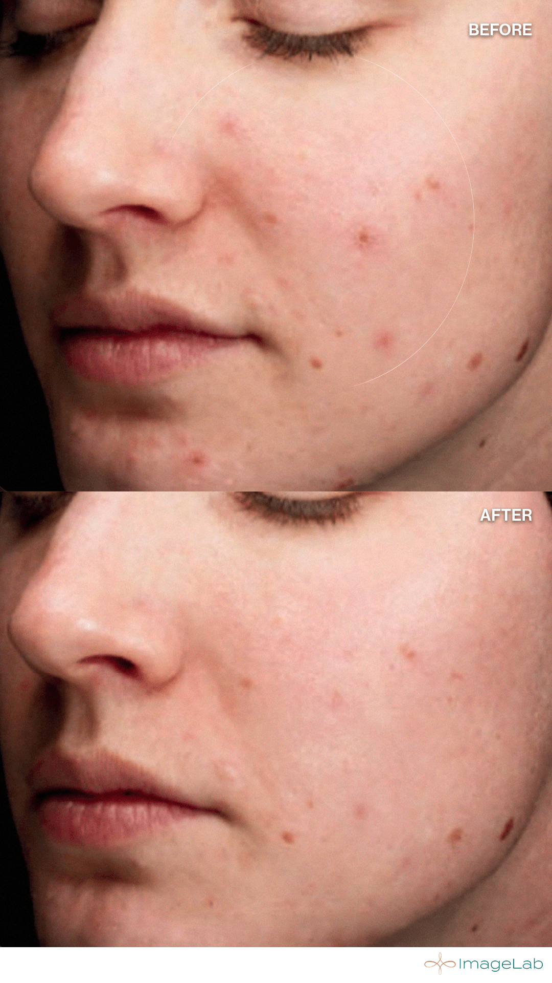 Before and after result